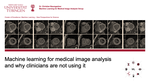 Machine learning for medical image analysis and why clinicians are not using it